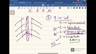 Medullary Syndrome Neurology04 FCPS Part01 Batch Whats App 01878342090 [upl. by Faina657]