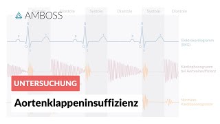 Aortenklappeninsuffizienz  Herzgeräusch  AMBOSS Video [upl. by Sammy]