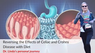 Reversing the Effects of Celiac and Crohns Disease with Diet Dr Linda’s personal journey [upl. by Liu]