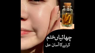 How to freckles treatment at home  چھائیاں ختم کرنے کا آسان حل [upl. by Stevie]