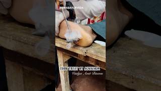 Live corn Treatment by bams student shorts [upl. by Ahsiled]