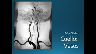 Cuello Vasos [upl. by Edveh]