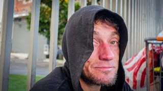 Los Angeles Homeless Mans Isolation Is Causing Mental Health Challenges [upl. by Atekahs634]