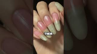 DONOT grow your nails 💅😨 [upl. by Ifill]