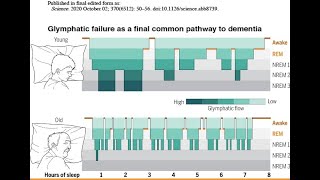 Sonno e malattia di Alzheimer marker predittivi e potenziali trattamenti [upl. by Lourdes79]