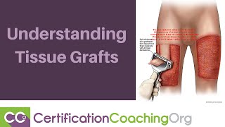 Understanding Tissue Grafts [upl. by Arocet]