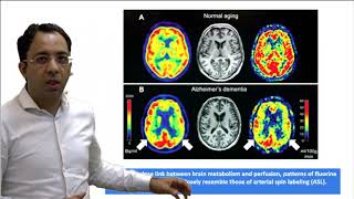 DAMS Medicine Unplugged Arterial Spin Labelling MRI [upl. by Afnin]