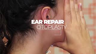 Otoplasty Ear Surgery  Before and After  Dr David Stoker [upl. by Haidebez]