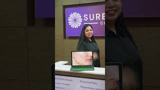 Even You Can Also Get Rid Of Acne  📞 7678265141 Surecure Clinic  Dr Suchita [upl. by Offen247]