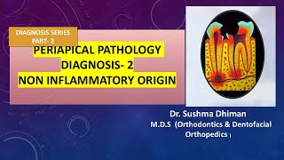 Periapical Pathology  Non inflammatory and non odontogenic lesions [upl. by Gereron604]