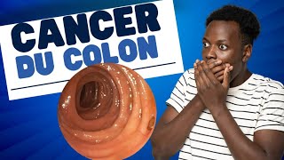 quotVaincre le cancer du côlon  Découvrez l’intérieur d’un colon malade  quot [upl. by Ennyl]