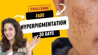 Incredible 30Day Hyperpigmentation Removal Remedy at Home  Nipun Kapurs Expert Skincare Routines [upl. by Ianej706]