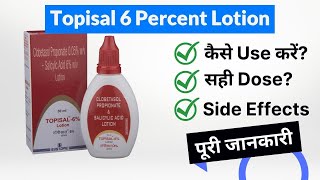 Topisal 6 Percent Lotion Uses in Hindi  Side Effects  Dose [upl. by Ellekim87]