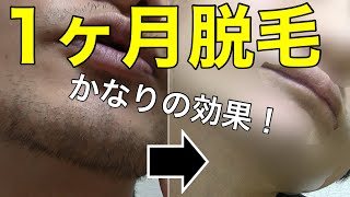 【ガチ検証】家庭用脱毛器を１ヶ月使ってみた結果…【BoSidin ボシディン】 [upl. by Macario]