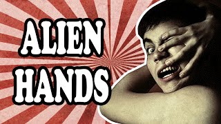 The Curious Case of Alien Hand Syndrome [upl. by Ttelracs]