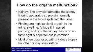 Amyloidosis Foundation patient webinar quotAmyloidosis 101quot [upl. by Ynnad416]