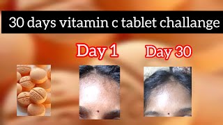 vitamin c tablet 30 days challange in tamil [upl. by Xuaegram330]