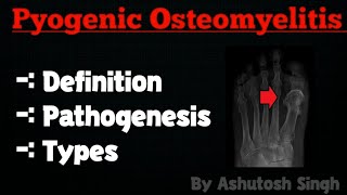 OSTEOMYELITIS Pathology [upl. by Shir]