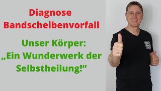 Diagnose Bandscheibenvorfall  Kann der BSV vom Körper abgebaut werden und wie lange dauert es [upl. by Repsaj939]