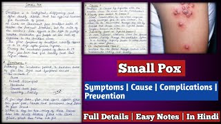 Small Pox  Small Pox  symptoms causes complications and prevention [upl. by Ayatal]