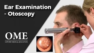 Otoscopy Ear Examination  ENT [upl. by Sissy]