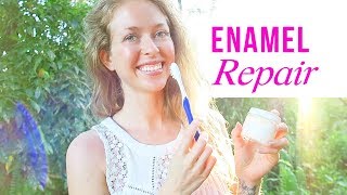 How I Naturally Restored My Enamel and Remineralized My Teeth [upl. by Ivah]