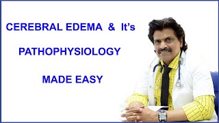 CEREBERAL EDEMA amp its PATHOPHYSIOLOGY MADE EASY [upl. by Ayifas98]