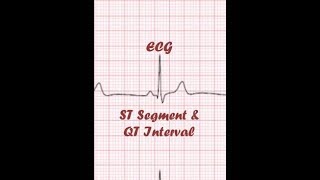 ECG for NEET and USMLE  ST segment and QT interval [upl. by Haon]