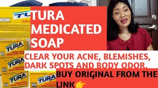 TURA MEDICATED SOAPTO CLEAR ACNE BODY ODOUR BLEMISHES DANDRUFF DARk SPOTUSE AS ANTIBACTERIAL [upl. by Kerrin965]