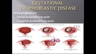 Histology of partial mole [upl. by Yatnuahc487]