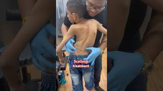 chiropractor Scoliosistreatment rkm drrajneeshkant [upl. by Nnorahs350]