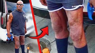 WTF Happened to Ronnie Colemans Legs [upl. by Azeret]