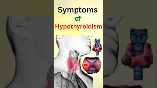 Symptoms of Hypothyoidism [upl. by Adnolahs616]