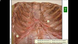 OSPE in anatomy of the cardiovascular system [upl. by Radu]