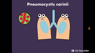 8 Pneumocystis carinii المتكيسة الرئوية [upl. by Nomzzaj]