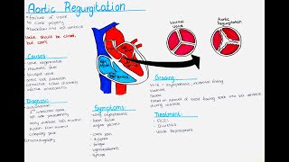 Aortic Regurgitation  Causes Symptoms Diagnosis Treatment Grading [upl. by Eneirda]