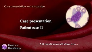 Patient case presentation case 1 [upl. by Frum]