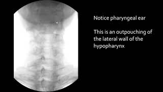 Swallowing Pharyngeal ear [upl. by Philender]