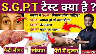 SGPT टेस्ट क्या हैं  Sgpt Test In Hindi  Sgpt Test  Sgpt Test Kya Hota Hai  What is SGPT Test [upl. by Rafiq]