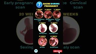 Types of Scans during Pregnancy  Anomaly Scan  3D scan in Pregnancy shortsvideo pregnancy scans [upl. by Aicatsue453]