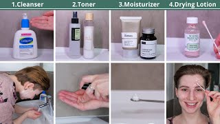 How to use Mario Badescu Drying Lotion in a Skincare Routine [upl. by Nywles]