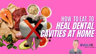 How To Eat To Heal And Reverse Dental Cavities Holistic Dentist Brisbane [upl. by Bonnell947]