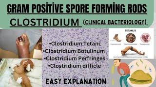 Gram Positive Rods Clostridium SpeciesTetani Botulinum Perfringes Difficle  micrombbsbds [upl. by Vevine424]