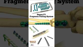 Depuy F3 Fragment Plating System medical animation 3d short Biology with Aliya [upl. by Amby]