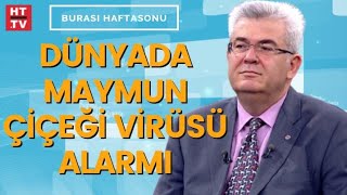 Maymun Çiçeği nasıl bir virüs Prof Dr Mustafa Hasöksüz anlattı [upl. by Elatia]