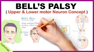 Bells palsy Upper and Lower Motor Neuron Lesions  Simplified [upl. by Ssidnac]