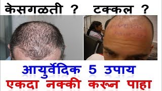 केस गळती थांबेल  टक्कलावर सुद्धा केस येतील   Hair Loss and Baldness Solutions in Marathi [upl. by Celeste]