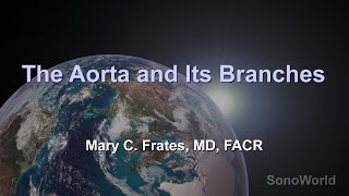 quotThe Aorta and its Branchesquot Ultrasound SonoWorld Lecture [upl. by Ayanad]