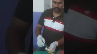 Foleys Catheter Removing [upl. by Ecnahc]