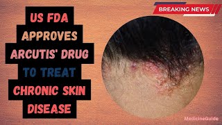 US FDA approves Arcutis drug to treat Chronic Skin Disease seborrheicdermatitis zoryve psoriasis [upl. by Ignatzia63]